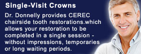 Single Visit Crowns